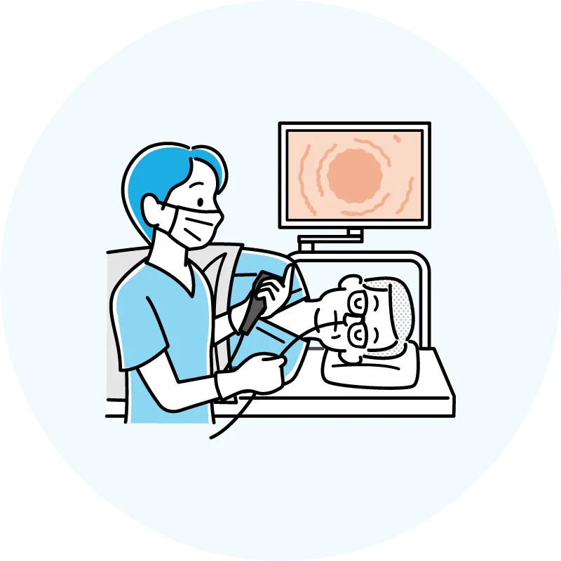 苦痛の少ない経鼻内視鏡（鼻からの胃カメラ）